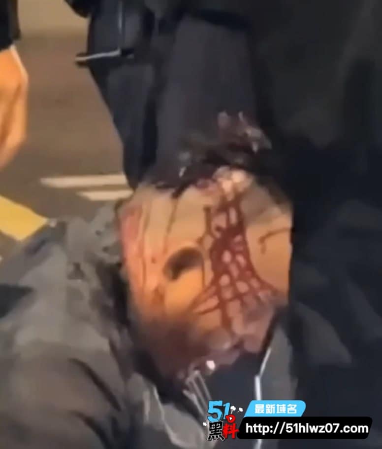 华东师大校门外卖员狂飙撞飞女大学生衣服撕裂私处外露画面太猛 奇闻