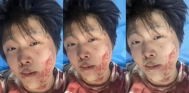 赵俊逸车库被精神小伙群殴满脸血视频流出这下真被打清醒了