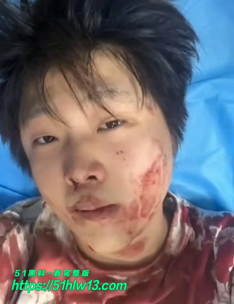 赵俊逸车库被精神小伙群殴满脸血视频流出这下真被打清醒了 抖音富二代