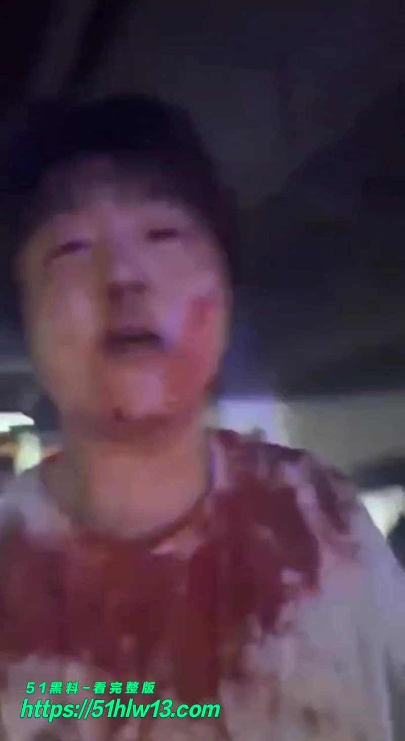 赵俊逸车库被精神小伙群殴满脸血视频流出这下真被打清醒了 精神小伙打人
