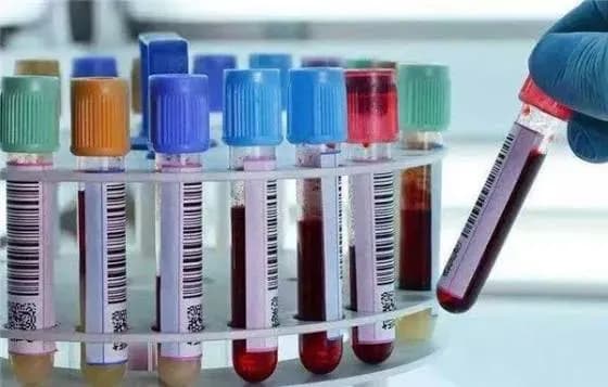 验血抽6到7管：是浪费该优化，还是一管多用行不通