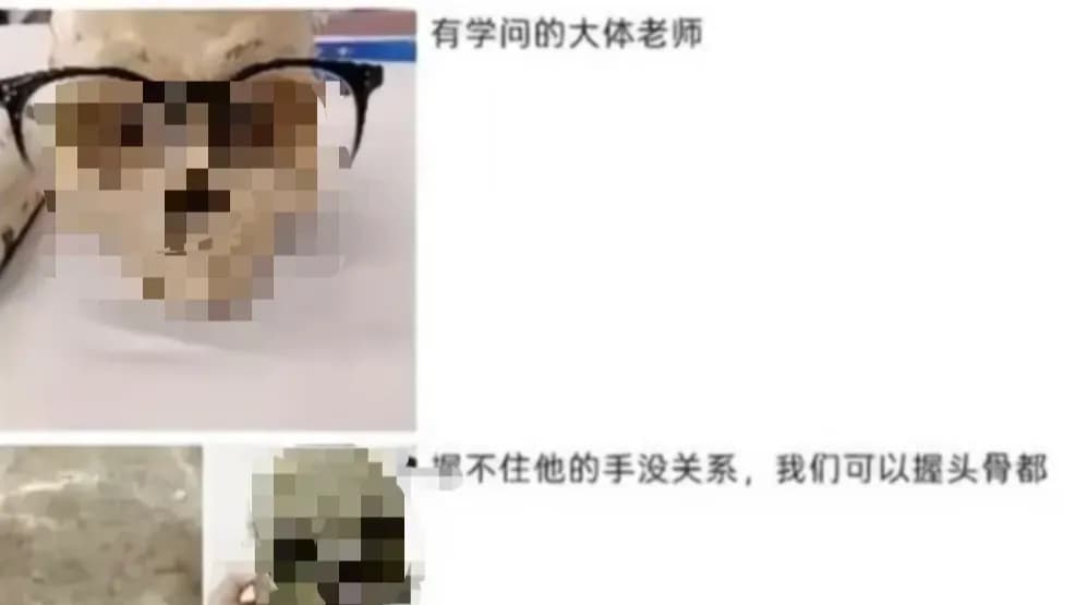 摆拍大体老师头骨被处分：处理够了，还是该更重
