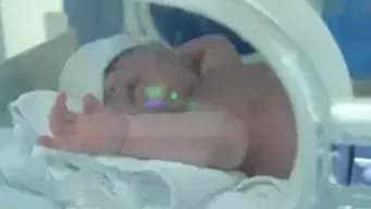 双胎一胎流产延迟105天分娩几问：健康女婴怎么保住的