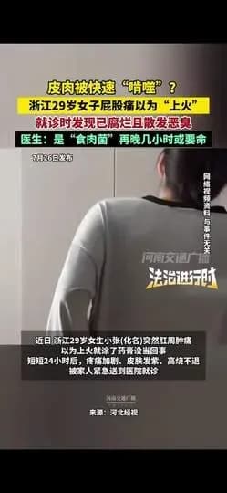 屁股痛以为上火,一查竟是食肉菌感染