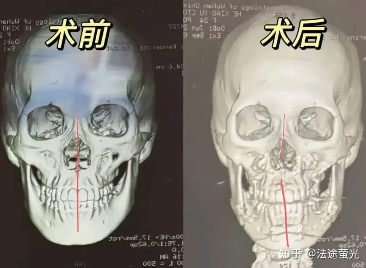 武大口腔通报三件套：停诊、调查、追责，这批表态经不经得住查