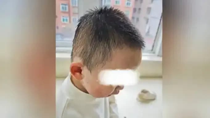 幼童误食洗衣凝珠：先喂蛋清，还是直接送医