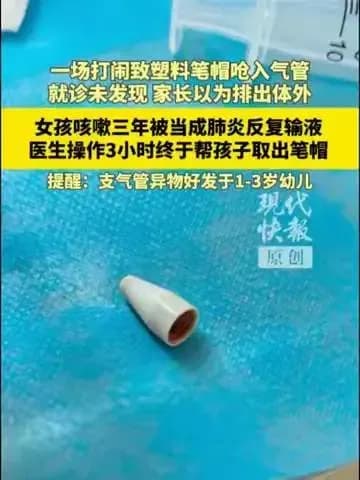 女孩咳嗽三年查出肺里有笔帽：这三年卡在哪一步？