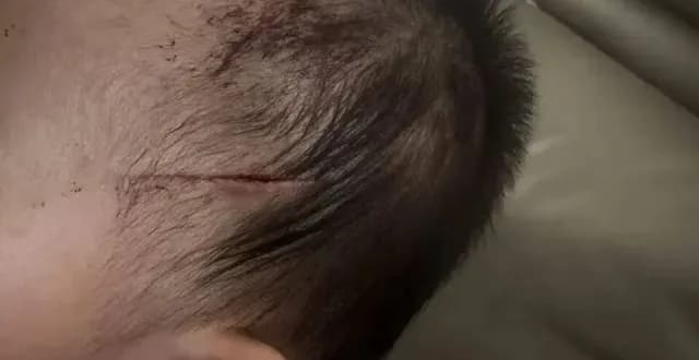 哈尔滨宾县命案热搜求证:17岁少年被刑拘是真的吗