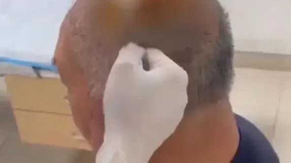 瓦片砸伤七旬夫妇索赔被拒:民宿说猴子踩的,该谁担